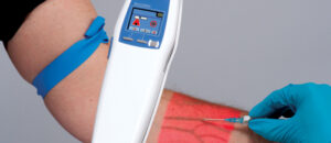 Vein Viewing System Accu Vein – AV400 – Carna Medicare